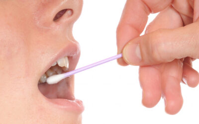 Ingyenes HIV és hepatitis szűrés  szerdánként