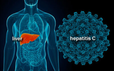 A Hepatitis C tünetei és kezelése